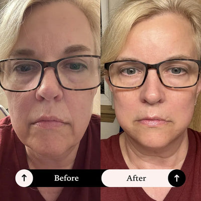 Face Lift Tape