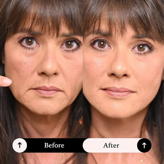 Face Lift Tape