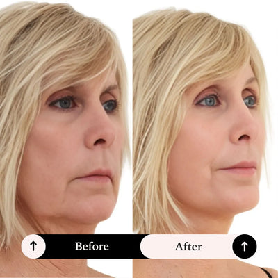 Face Lift Tape