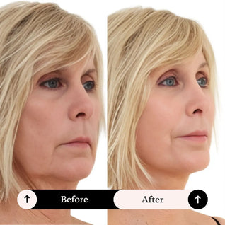 Face Lift Tape