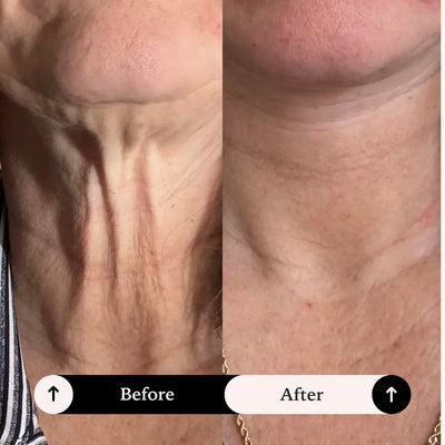 Face Lift Tape