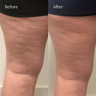 Amélie Body Sculptor