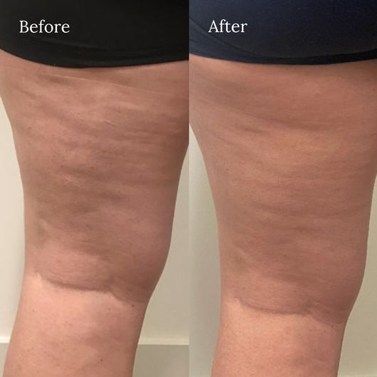 Amélie Body Sculptor